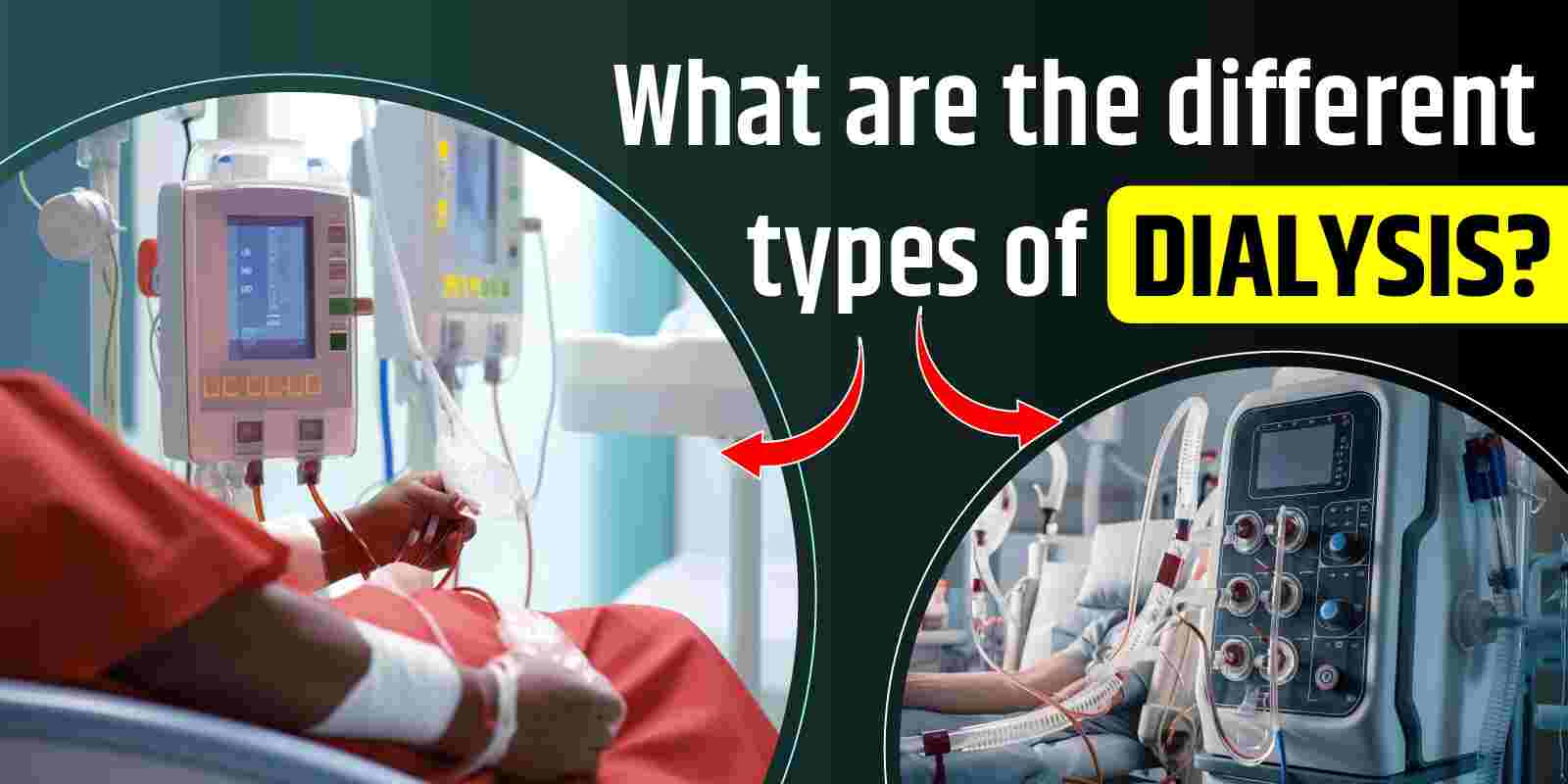 What are the different types of dialysis?